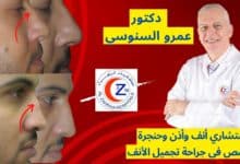 عمليات تجميل الأنف د. إستشارى عمرو السنوسى