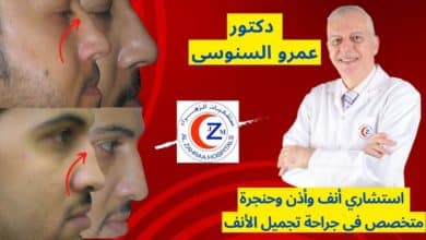 عمليات تجميل الأنف د. إستشارى عمرو السنوسى